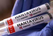 ÜST hantavirusa yoluxma sayının artdığını açıqladı