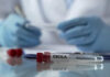 Ölkəmizdə Ebola riski varmı? – Rəsmi açıqlama