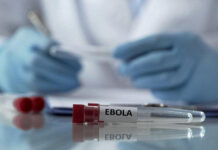 Ölkəmizdə Ebola riski varmı? – Rəsmi açıqlama