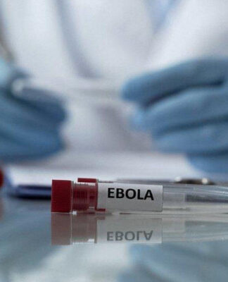Ölkəmizdə Ebola riski varmı? – Rəsmi açıqlama
